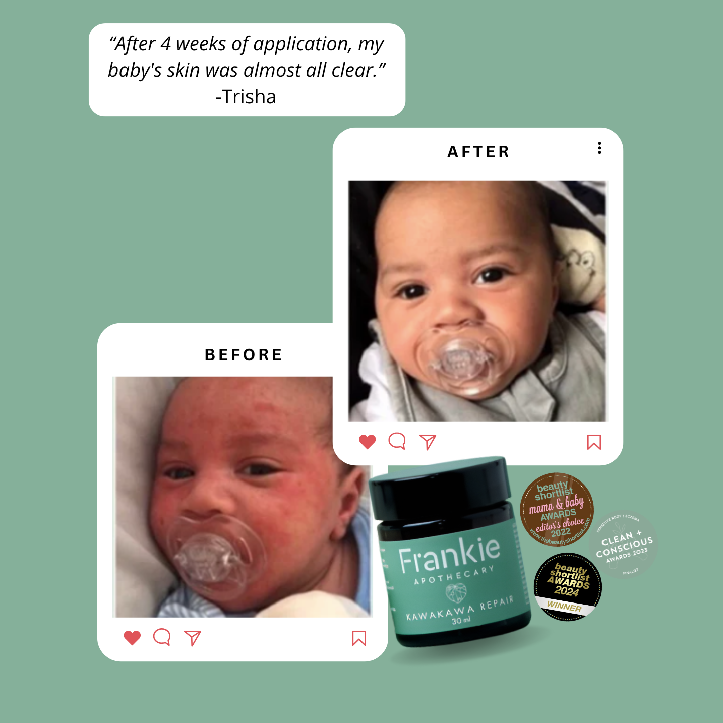 Kawakawa Repair Balm - Winner, Best SOS/Healing Balm 2024