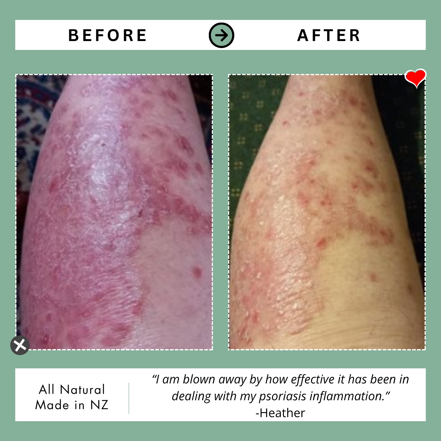 Kawakawa Repair Balm - Winner, Best SOS/Healing Balm 2024