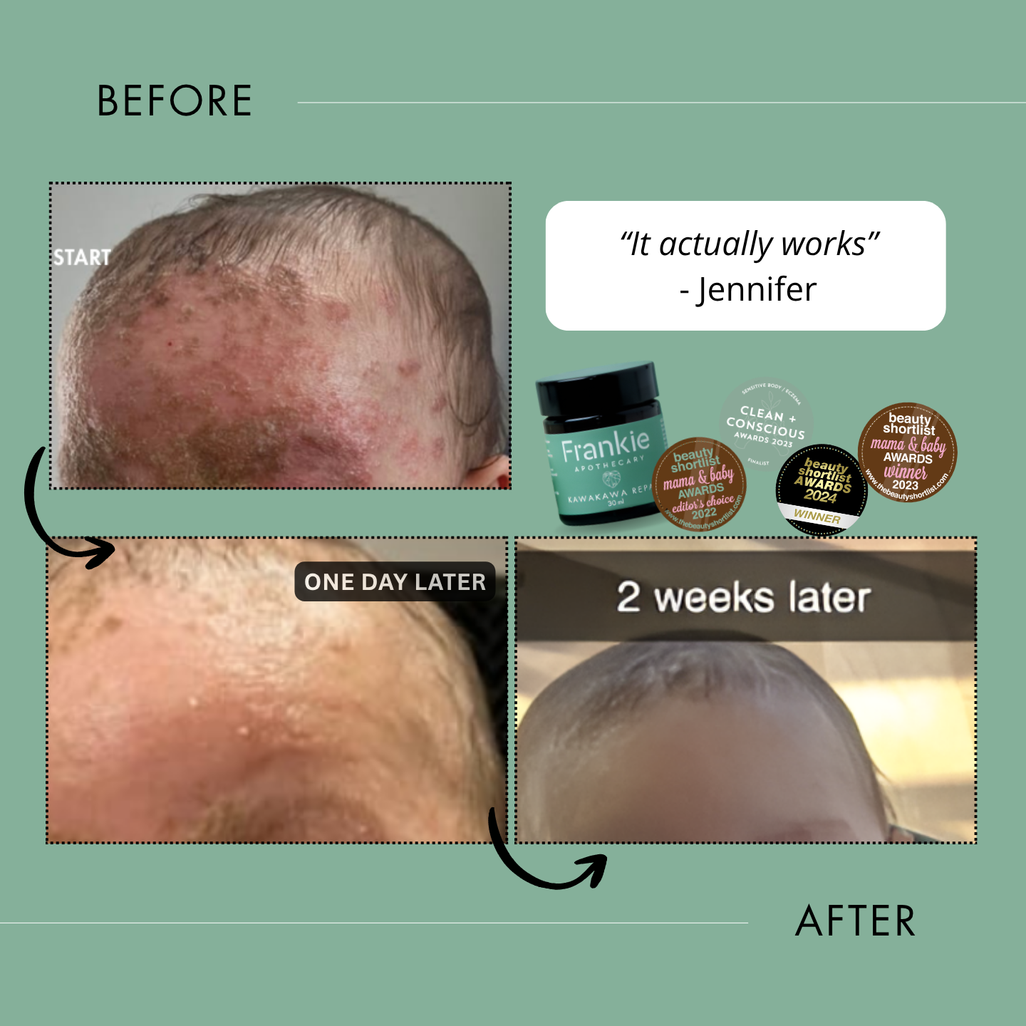 Kawakawa Repair Balm - Winner, Best SOS/Healing Balm 2024