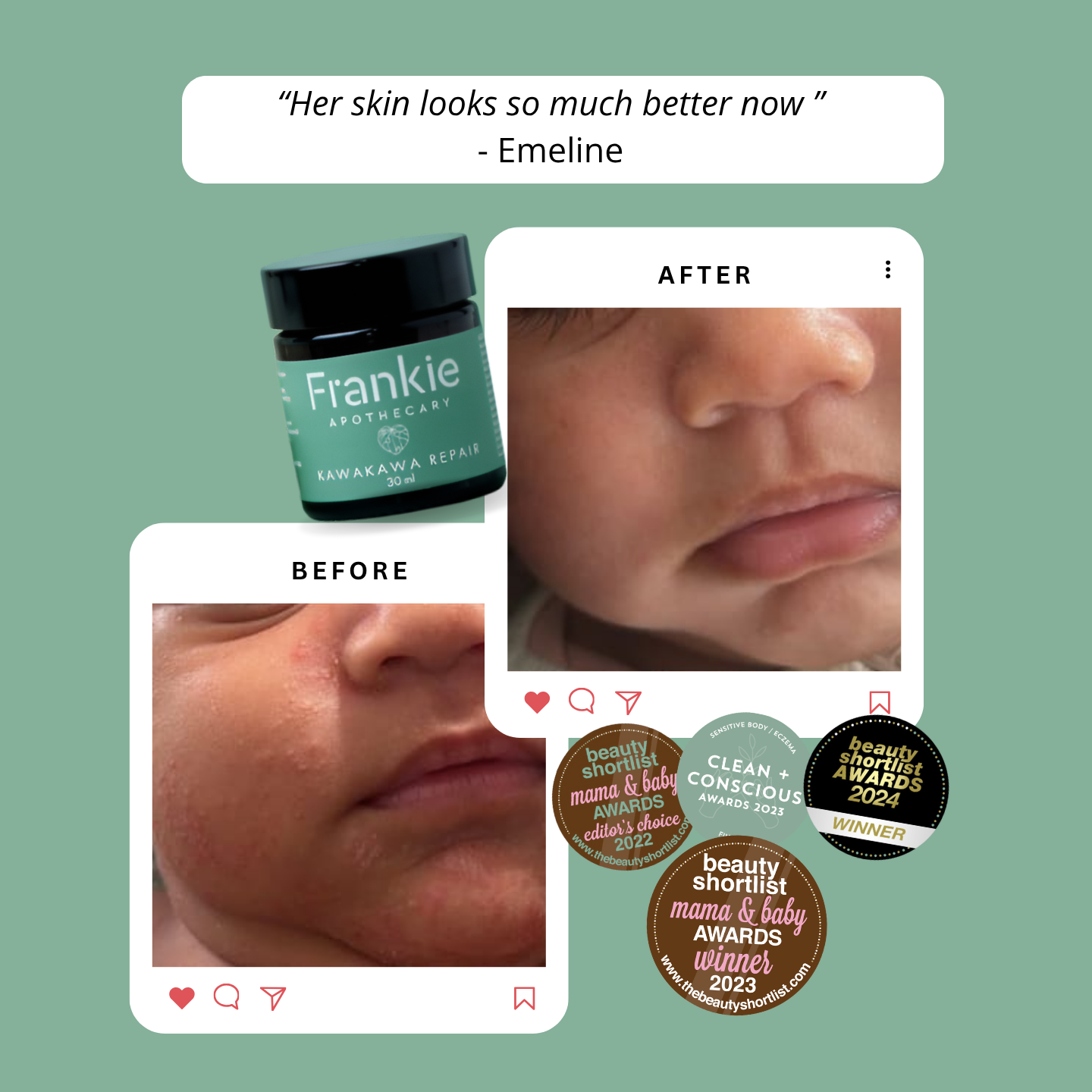 Kawakawa Repair Balm - Winner, Best SOS/Healing Balm 2024