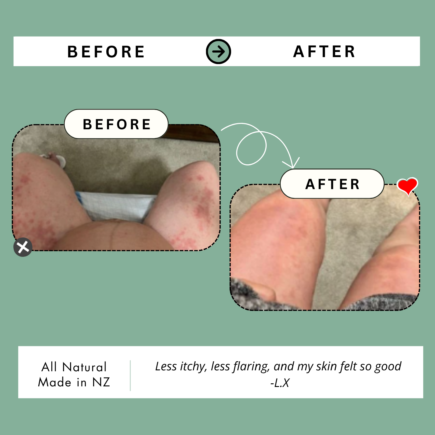 Kawakawa Repair Balm - Winner, Best SOS/Healing Balm 2024