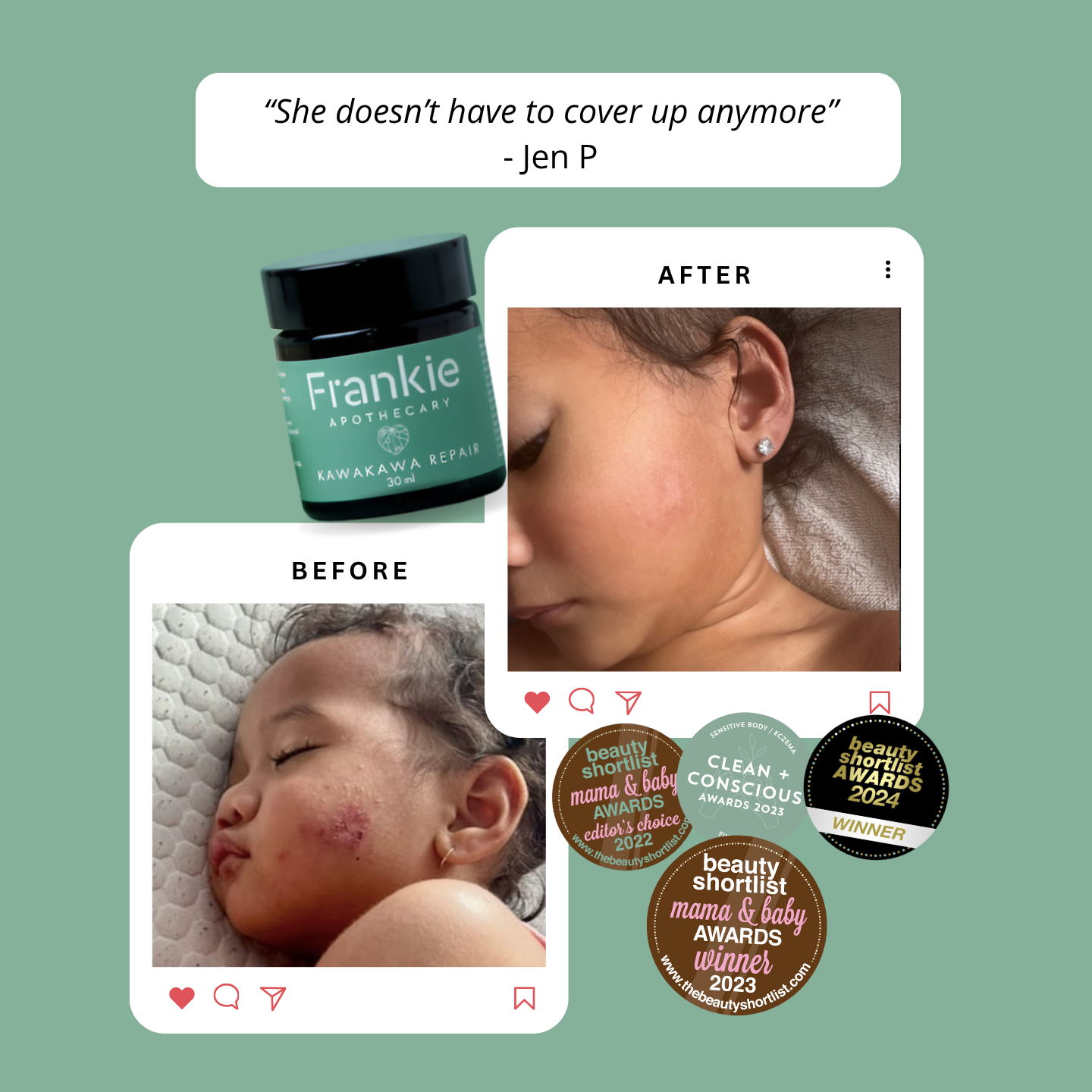 Kawakawa Repair Balm - Winner, Best SOS/Healing Balm 2024