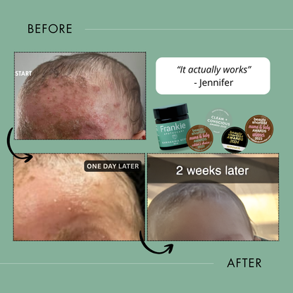 Kawakawa Repair Balm - Winner, Best SOS/Healing Balm 2024