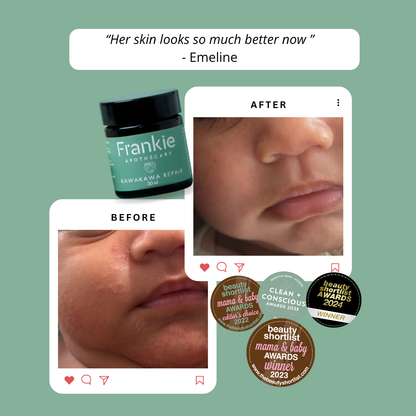 Kawakawa Repair Balm - Winner, Best SOS/Healing Balm 2024