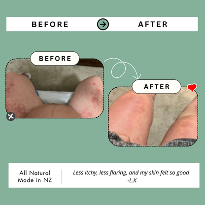 Kawakawa Repair Balm - Winner, Best SOS/Healing Balm 2024